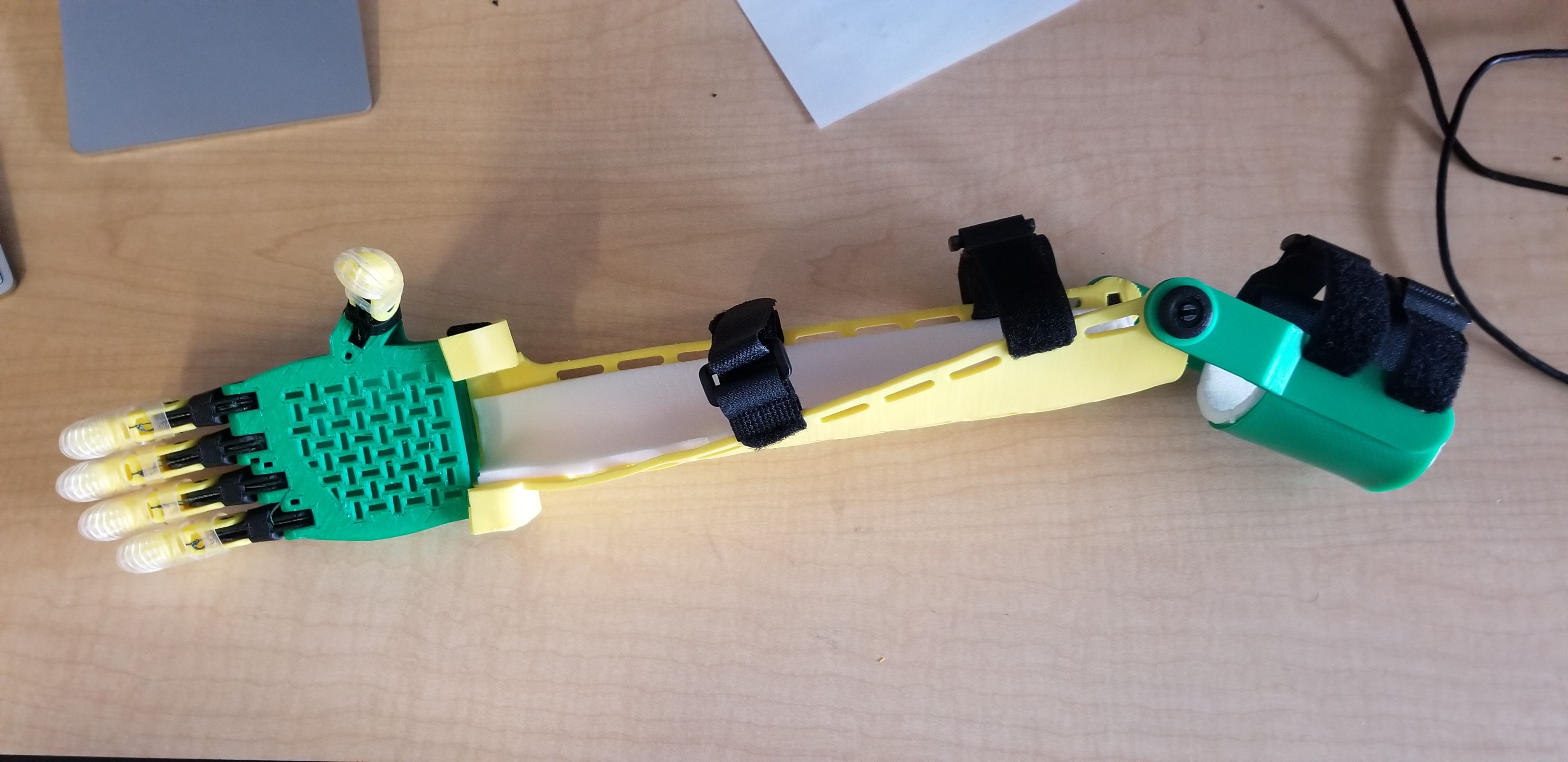 Prosthetic Arm